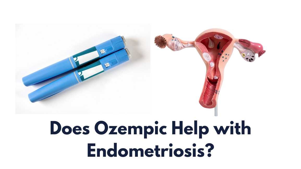 Does Ozempic Help with Endometriosis