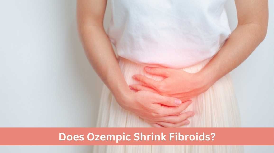 Does Ozempic Shrink Fibroids?